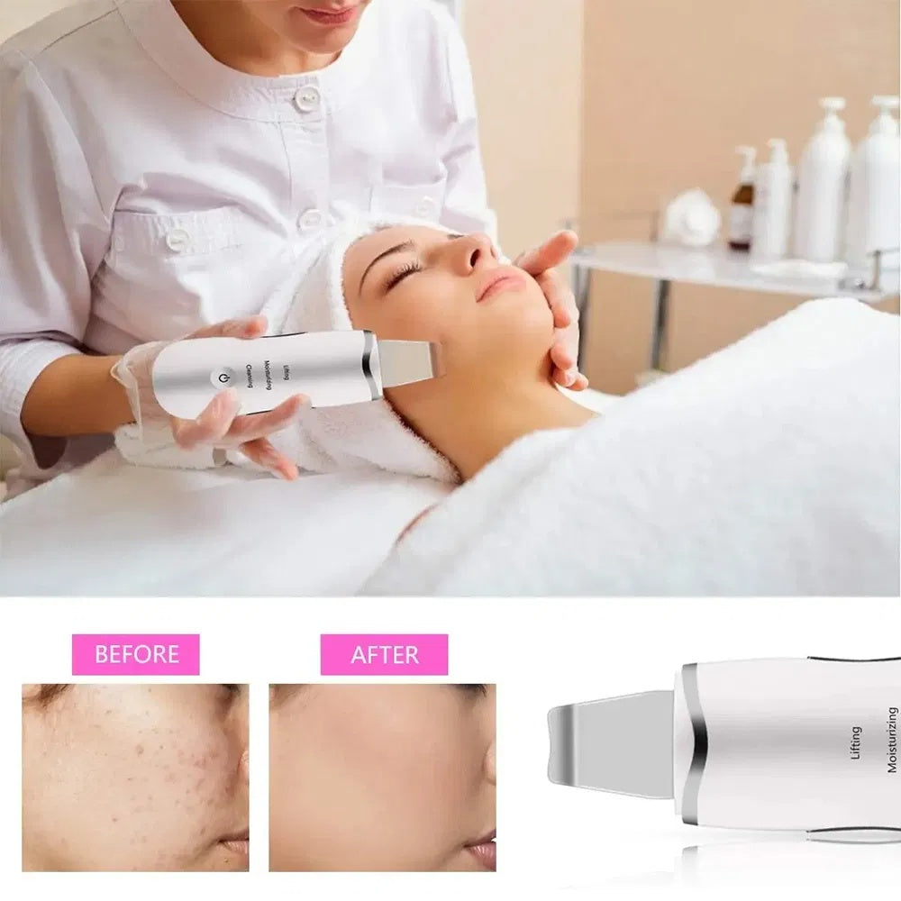 3-in-1 Ultrasonic Facial Spatula For Deep Cleansing, Electric